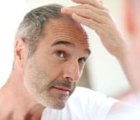 Czy łysienie ma związek z wiekiem?